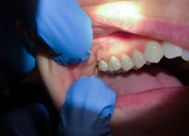 Best Weekend Emergency Dentist in Centre Hall, PA